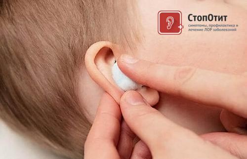 Спиртовая турунда в ухо. Как сделать турунду в ухо при отите