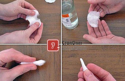 Как сделать турунды в уши. Как сделать турунду в ухо при отите