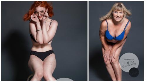 Без комплексов. Фотосессия без комплексов: все женщины прекрасны! Или нет?