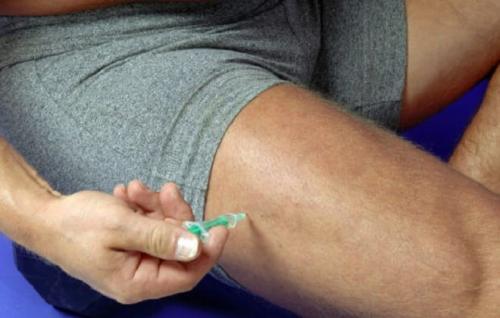 Как самому сделать укол внутримышечно. Техника выполнения укола в бедро и как сделать инъекцию внутримышечно самому себе