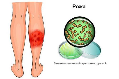 Как бороться с паршой на яблоне осенью. Почему так трудно бороться с паршой на яблоне 01