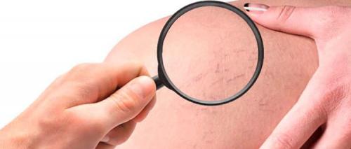 Нефролепис польза. Все о растении нефролепис в народной медицине