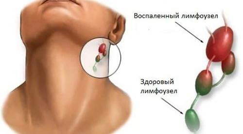 Нефролепис польза. Все о растении нефролепис в народной медицине