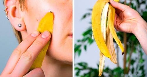 Кожура от банана для лица. Кожура банана для лица. Польза, вред, рецепты от прыщей, синяков в косметологии