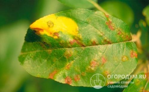 Парша лечение. Описание заболевания